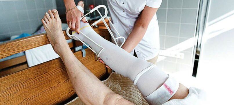 ciorapi compresivi pentru tratamentul varicelor